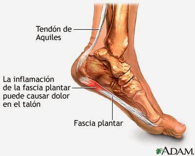 tratamiento natural para espolones tratamiento natural para espolones
